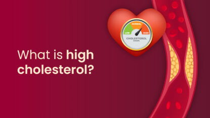 What is high cholesterol